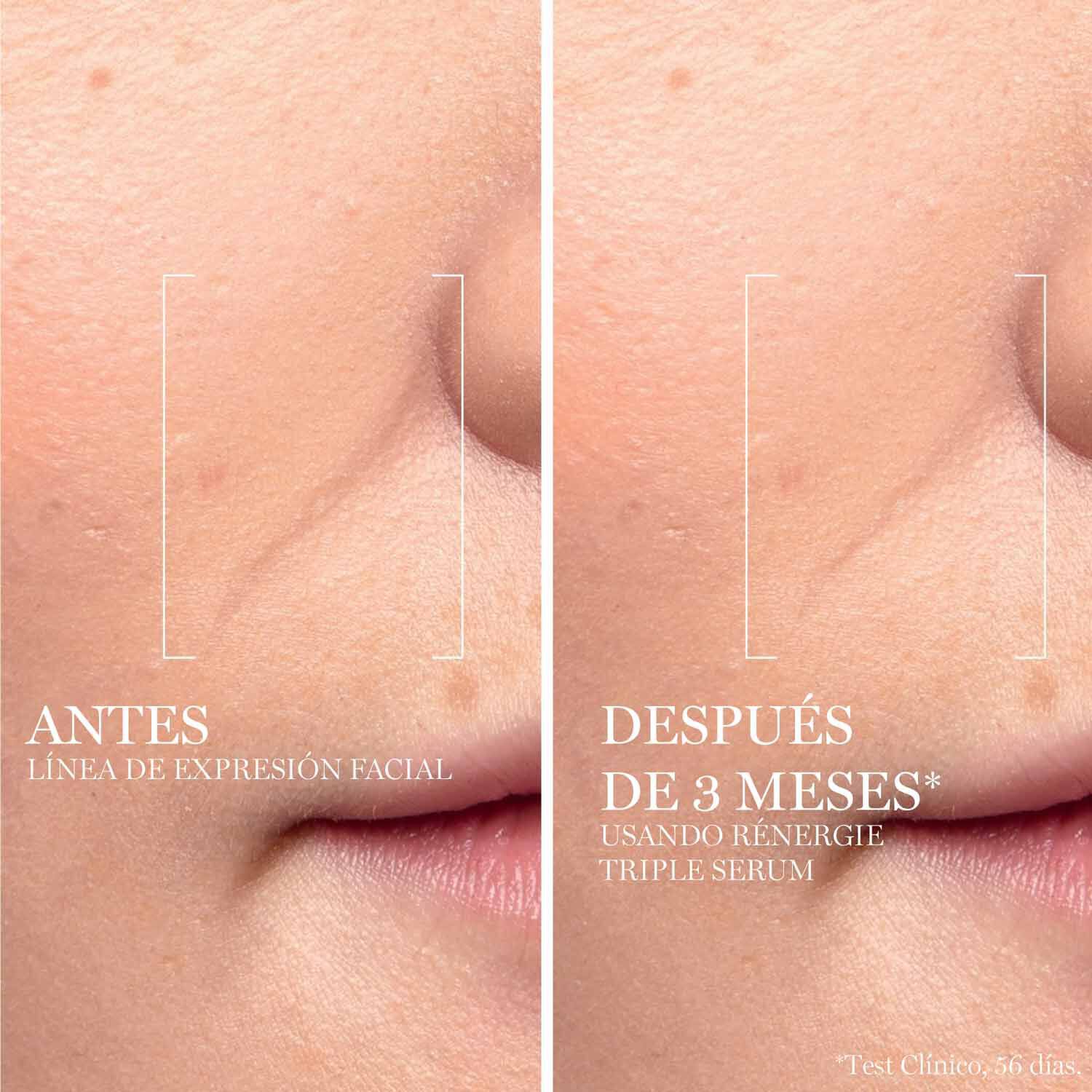 RENERGIE  H.C.F. TRIPLE SERUM