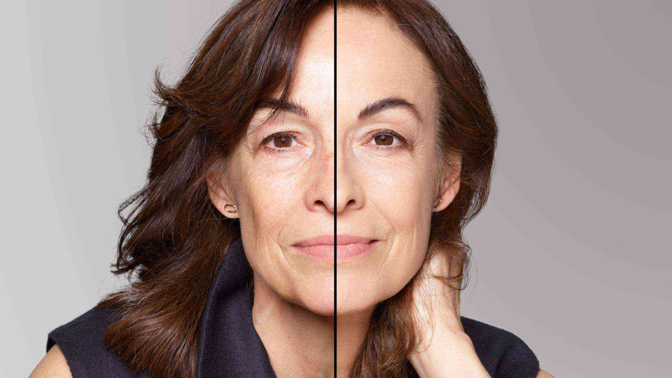 BEFORE/AFTER