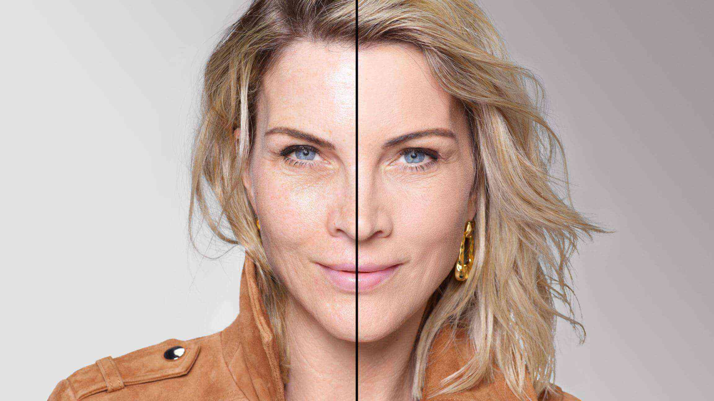 BEFORE/AFTER