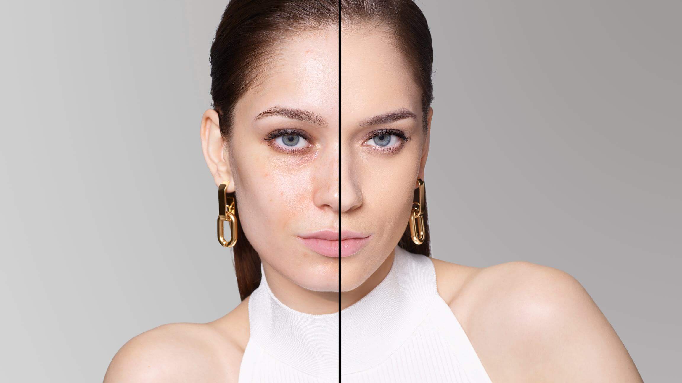 BEFORE/AFTER