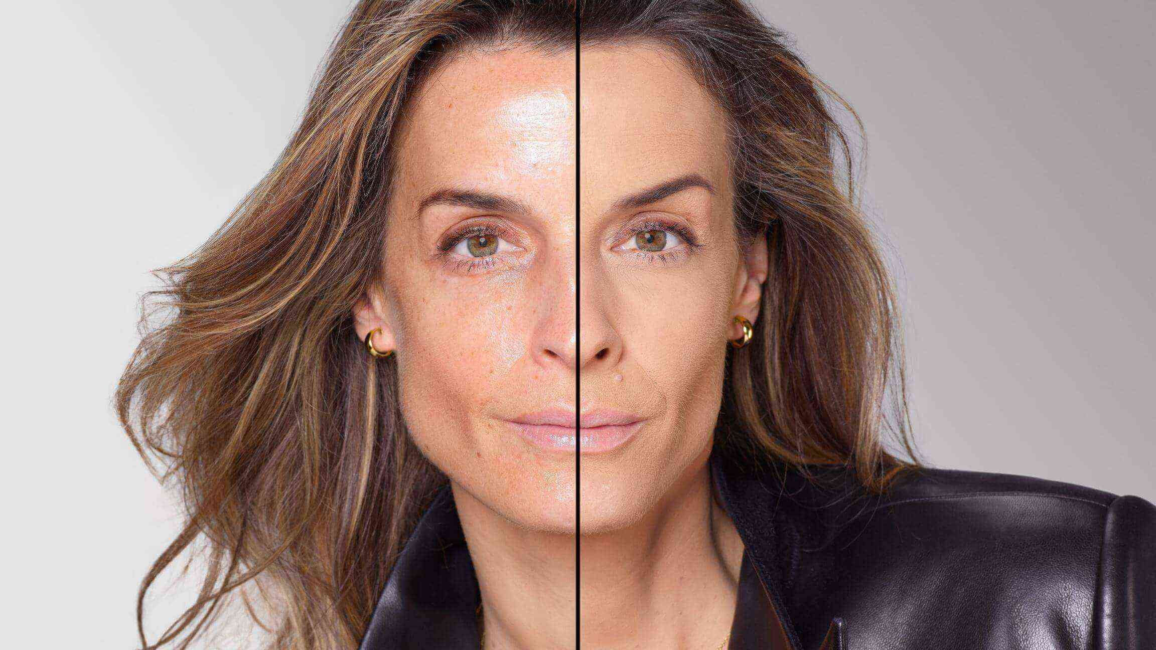 BEFORE/AFTER