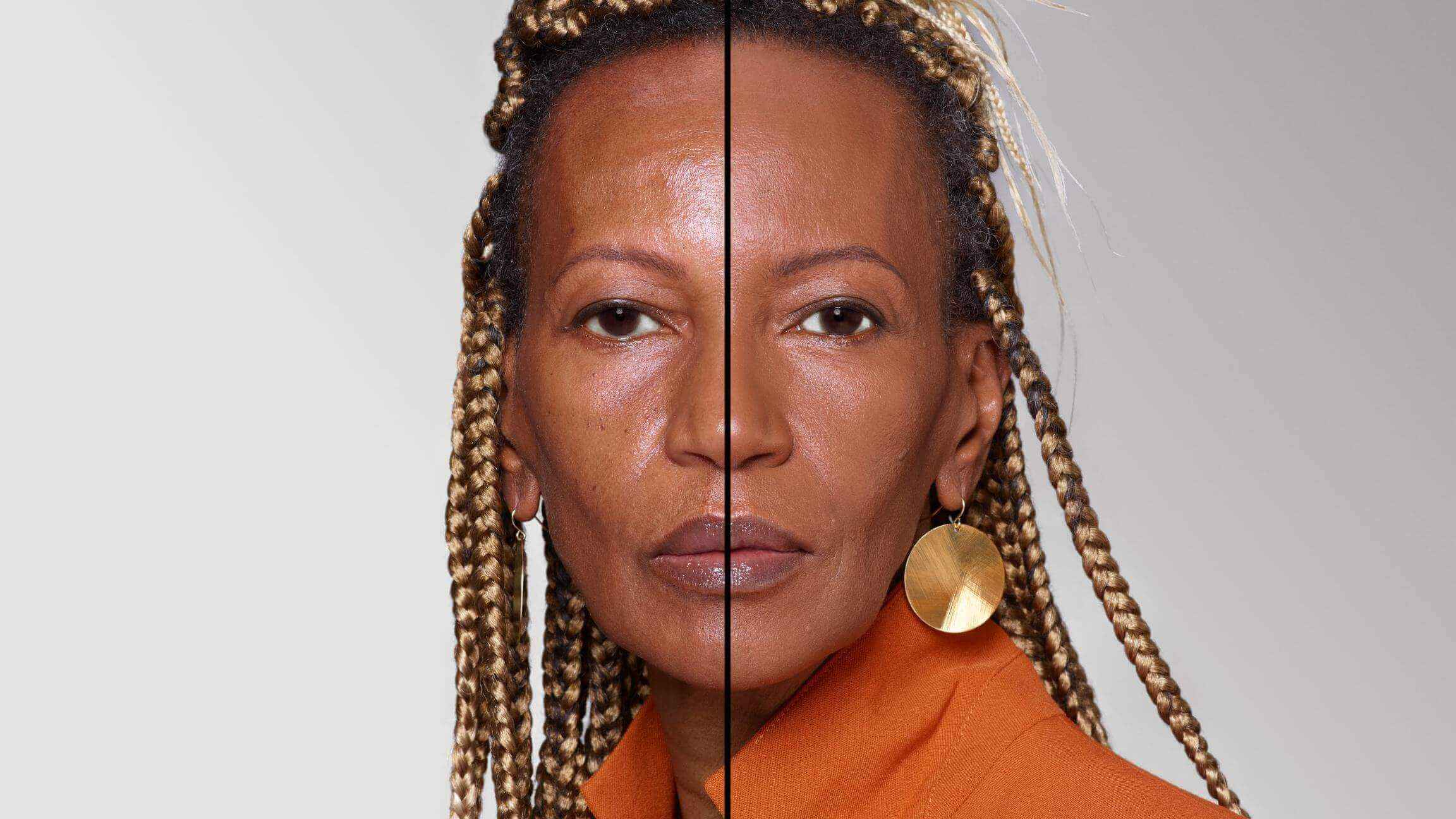 BEFORE/AFTER
