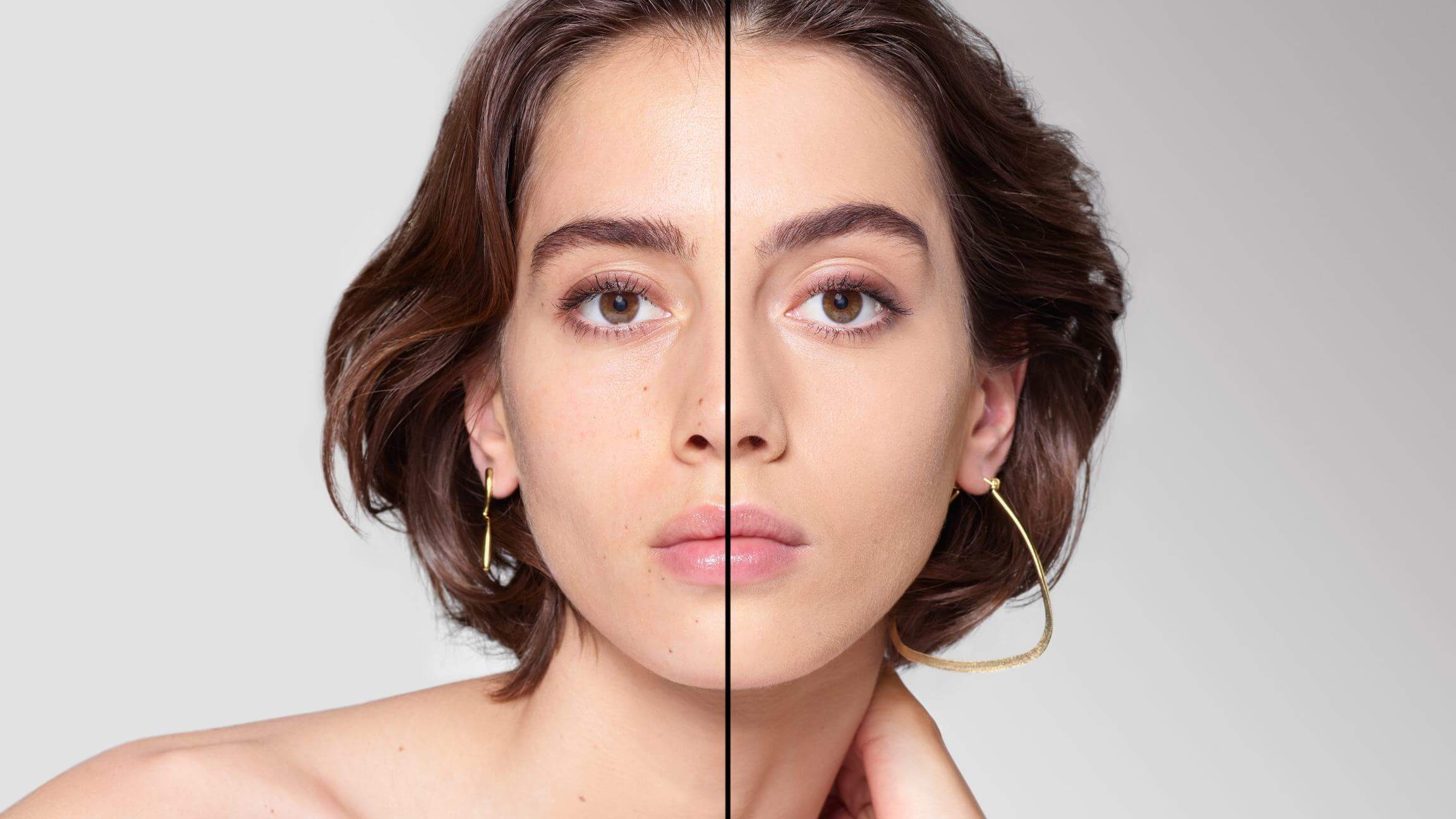BEFORE/AFTER