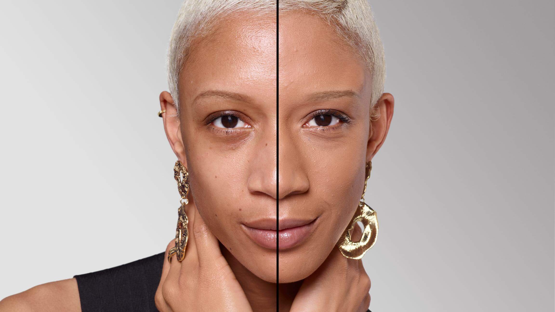 BEFORE/AFTER